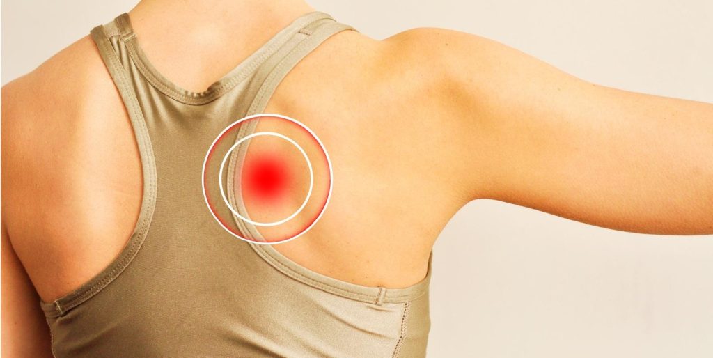 Douleur haut du dos entre les omoplates soulager kné du sport Toulouse